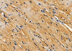 Invitrogen AMFR Polyclonal Antibody 100 &mu;L; Unconjugated:Antibodies,