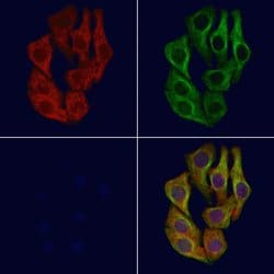 Invitrogen IRG1 Polyclonal Antibody 100 &mu;L; Unconjugated:Antibodies,