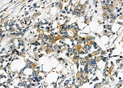 Invitrogen PPT1 Polyclonal Antibody 100 &mu;L; Unconjugated:Antibodies,