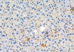 Invitrogen UGT2B17 Polyclonal Antibody 100 &mu;L; Unconjugated:Antibodies,