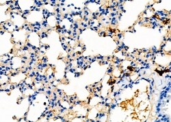 Invitrogen UGT2B17 Polyclonal Antibody 100 &mu;L; Unconjugated:Antibodies,