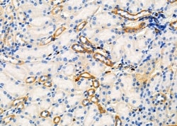 Invitrogen UGT2B17 Polyclonal Antibody 100 &mu;L; Unconjugated:Antibodies,