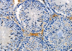 Invitrogen™ Cathelicidin Polyclonal Antibody