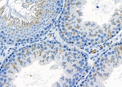 Invitrogen Cathelicidin Polyclonal Antibody 100 &mu;L; Unconjugated:Antistoffer