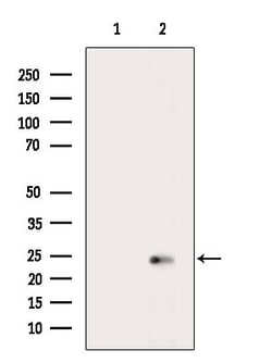 Invitrogen Cathelicidin Polyclonal Antibody 100 &mu;L; Unconjugated:Antistoffer
