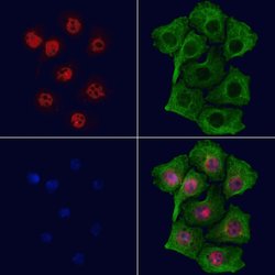 Invitrogen GLIS3 Polyclonal Antibody 100 &mu;L; Unconjugated:Antibodies,