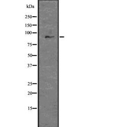Invitrogen GLIS3 Polyclonal Antibody 100 &mu;L; Unconjugated:Antibodies,