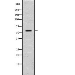 Invitrogen GLP1R Polyclonal Antibody 100 &mu;L; Unconjugated:Antibodies,