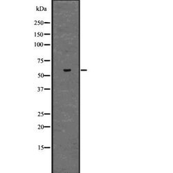 Invitrogen ZNF306 Polyclonal Antibody 100 &mu;L; Unconjugated:Antibodies,