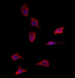 SOD3 Polyclonal Antibody:Antibodies, Polyclonal