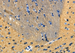 SOD3 Polyclonal Antibody:Antibodies, Polyclonal