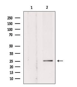 SOD3 Polyclonal Antibody:Antibodies, Polyclonal