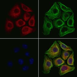 FGF3 Polyclonal Antibody:Antibodies, Polyclonal