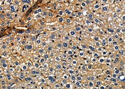 FGF3 Polyclonal Antibody:Antibodies, Polyclonal