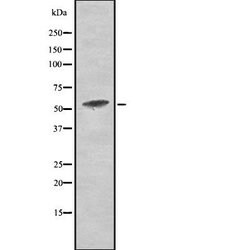 Invitrogen Phospho-PKM2 (Tyr105) Polyclonal Antibody 100 &mu;L; Unconjugated:Antibodies,