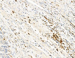 Invitrogen Phospho-PKM2 (Ser37) Polyclonal Antibody 100 &mu;L; Unconjugated:Antibodies,