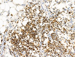 Invitrogen Phospho-PKM2 (Ser37) Polyclonal Antibody 100 &mu;L; Unconjugated:Antibodies,