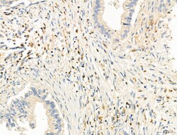 Invitrogen Phospho-PKM2 (Ser37) Polyclonal Antibody 100 &mu;L; Unconjugated:Antibodies,