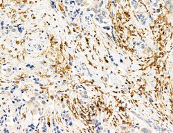 Invitrogen Phospho-PKM2 (Ser37) Polyclonal Antibody 100 &mu;L; Unconjugated:Antibodies,