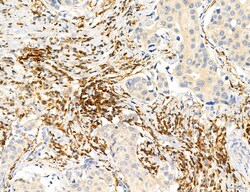 Invitrogen Phospho-PKM2 (Ser37) Polyclonal Antibody 100 &mu;L; Unconjugated:Antibodies,