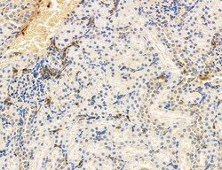Invitrogen Phospho-PKM2 (Ser37) Polyclonal Antibody 100 &mu;L; Unconjugated:Antibodies,