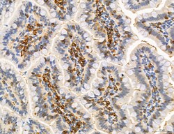 Invitrogen Phospho-PKM2 (Ser37) Polyclonal Antibody 100 &mu;L; Unconjugated:Antibodies,