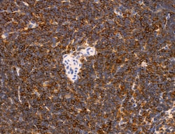 Invitrogen Phospho-PKM2 (Ser37) Polyclonal Antibody 100 &mu;L; Unconjugated:Antibodies,