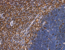 Invitrogen Phospho-PKM2 (Ser37) Polyclonal Antibody 100 &mu;L; Unconjugated:Antibodies,