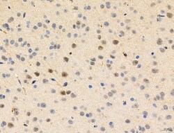 Invitrogen Phospho-PKM2 (Ser37) Polyclonal Antibody 100 &mu;L; Unconjugated:Antibodies,