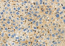 Invitrogen SOAT1 Polyclonal Antibody 100 &mu;L | Buy Online | Invitrogen&trade; | Fisher Scientific