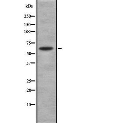 Invitrogen SOAT1 Polyclonal Antibody 100 &mu;L | Buy Online | Invitrogen&trade; | Fisher Scientific