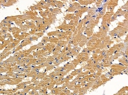 Invitrogen DAB2 Polyclonal Antibody 100 &mu;L; Unconjugated:Antibodies,
