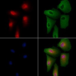 Invitrogen REST Polyclonal Antibody 100 &mu;L; Unconjugated:Antibodies,