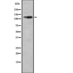 Invitrogen REST Polyclonal Antibody 100 &mu;L; Unconjugated:Antibodies,