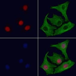 Invitrogen PABPN1 Polyclonal Antibody 100 &mu;L; Unconjugated:Antibodies,
