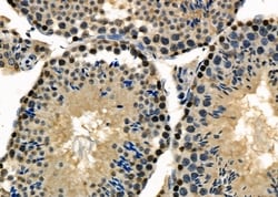 Invitrogen PABPN1 Polyclonal Antibody 100 &mu;L; Unconjugated:Antibodies,