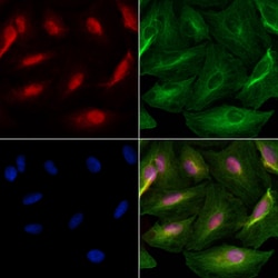 Invitrogen Cdc6 Polyclonal Antibody 100 &mu;L; Unconjugated:Antibodies,