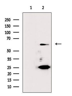 Invitrogen Cdc6 Polyclonal Antibody 100 &mu;L; Unconjugated:Antibodies,