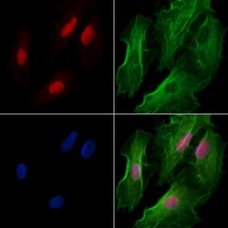 Invitrogen CTNNBL1 Polyclonal Antibody 100 &mu;L | Buy Online | Invitrogen&trade; | Fisher Scientific