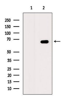 Invitrogen CTNNBL1 Polyclonal Antibody 100 &mu;L | Buy Online | Invitrogen&trade; | Fisher Scientific