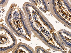 C1QA Polyclonal Antibody:Antibodies, Polyclonal