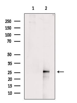 C1QA Polyclonal Antibody:Antibodies, Polyclonal