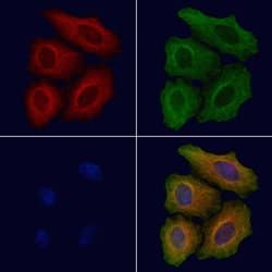 C1QA Polyclonal Antibody:Antibodies, Polyclonal