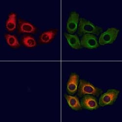 Invitrogen PSMA Polyclonal Antibody 100 &mu;L; Unconjugated:Antibodies,