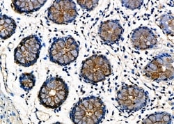 Invitrogen NDUFAF1 Polyclonal Antibody 100 &mu;L; Unconjugated:Antibodies,