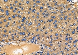 Invitrogen NDUFAF1 Polyclonal Antibody 100 &mu;L; Unconjugated:Antibodies,