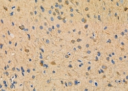 Invitrogen NDUFAF1 Polyclonal Antibody 100 &mu;L; Unconjugated:Antibodies,