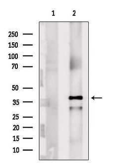Invitrogen NDUFAF1 Polyclonal Antibody 100 &mu;L; Unconjugated:Antibodies,