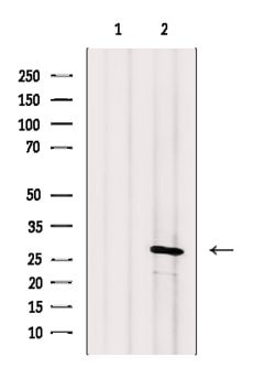Invitrogen Calpain S1 Polyclonal Antibody 100 &mu;L | Buy Online | Invitrogen&trade; | Fisher Scientific
