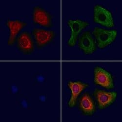 Invitrogen AP2S1 Polyclonal Antibody 100 &mu;L; Unconjugated:Antibodies,